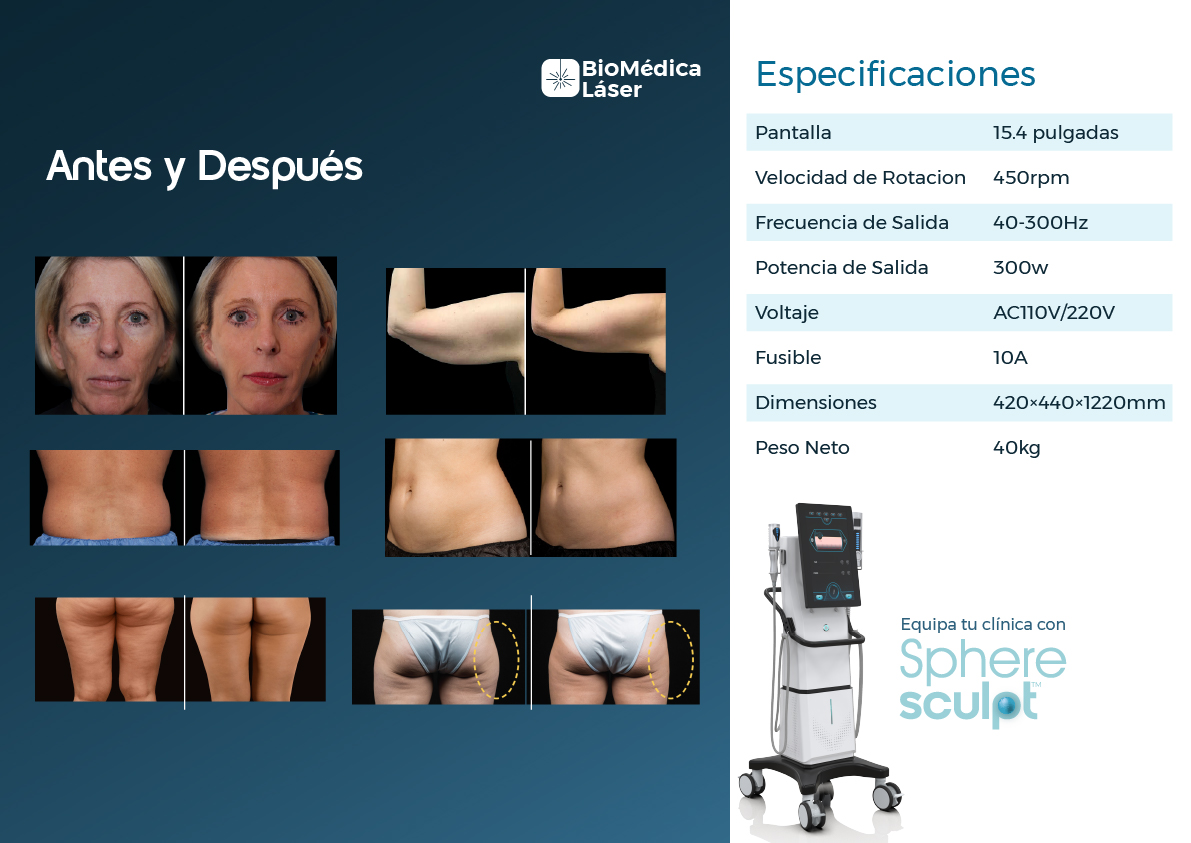 SphereSculpt equipo médico de rejuvenecimiento corporal y facial para medicos en el salvador, por biomédica laser